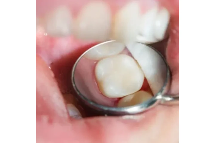 OSA Dental cover