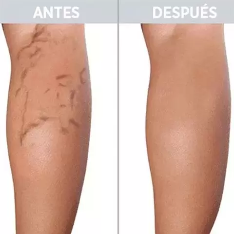 ART VASCULAR cover