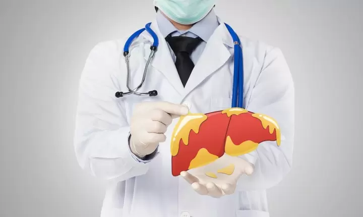 Cómo prevenir el hígado graso