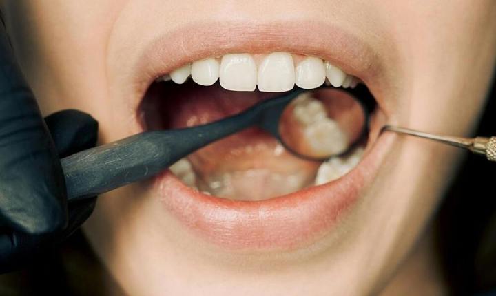¿Tengo microbios en la boca? 