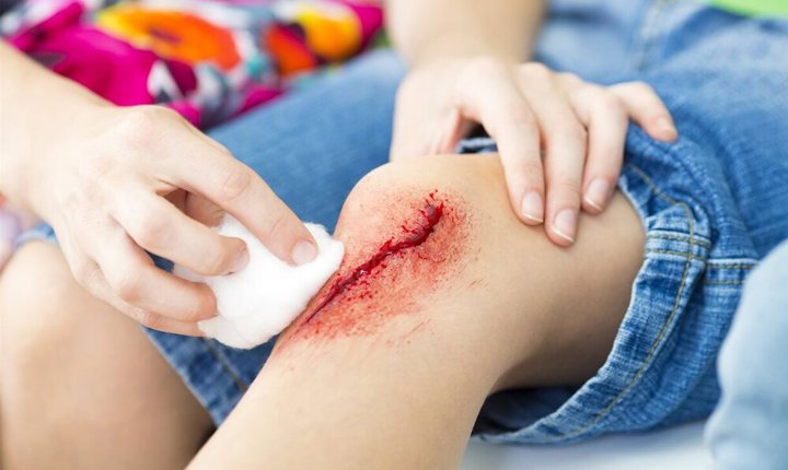 ¿Es bueno el peróxido para limpiar las heridas?