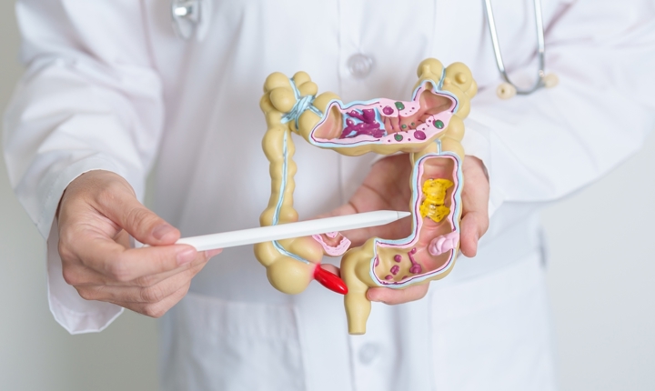 Alimentos para una microbiota sana