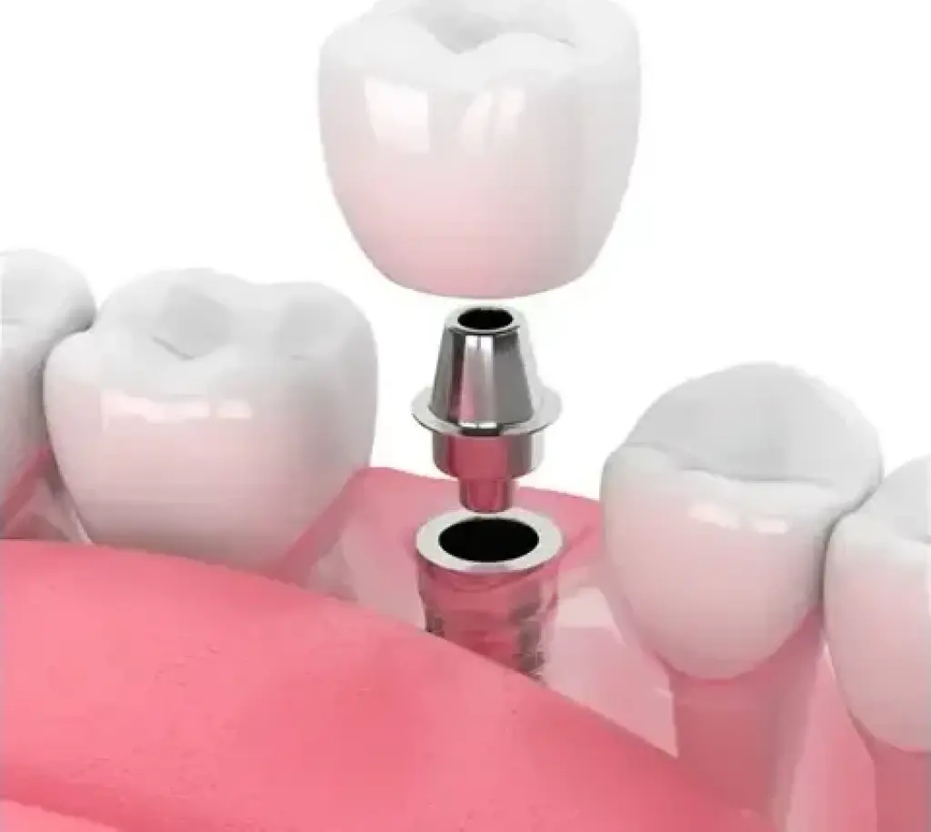 Dentista en Upland