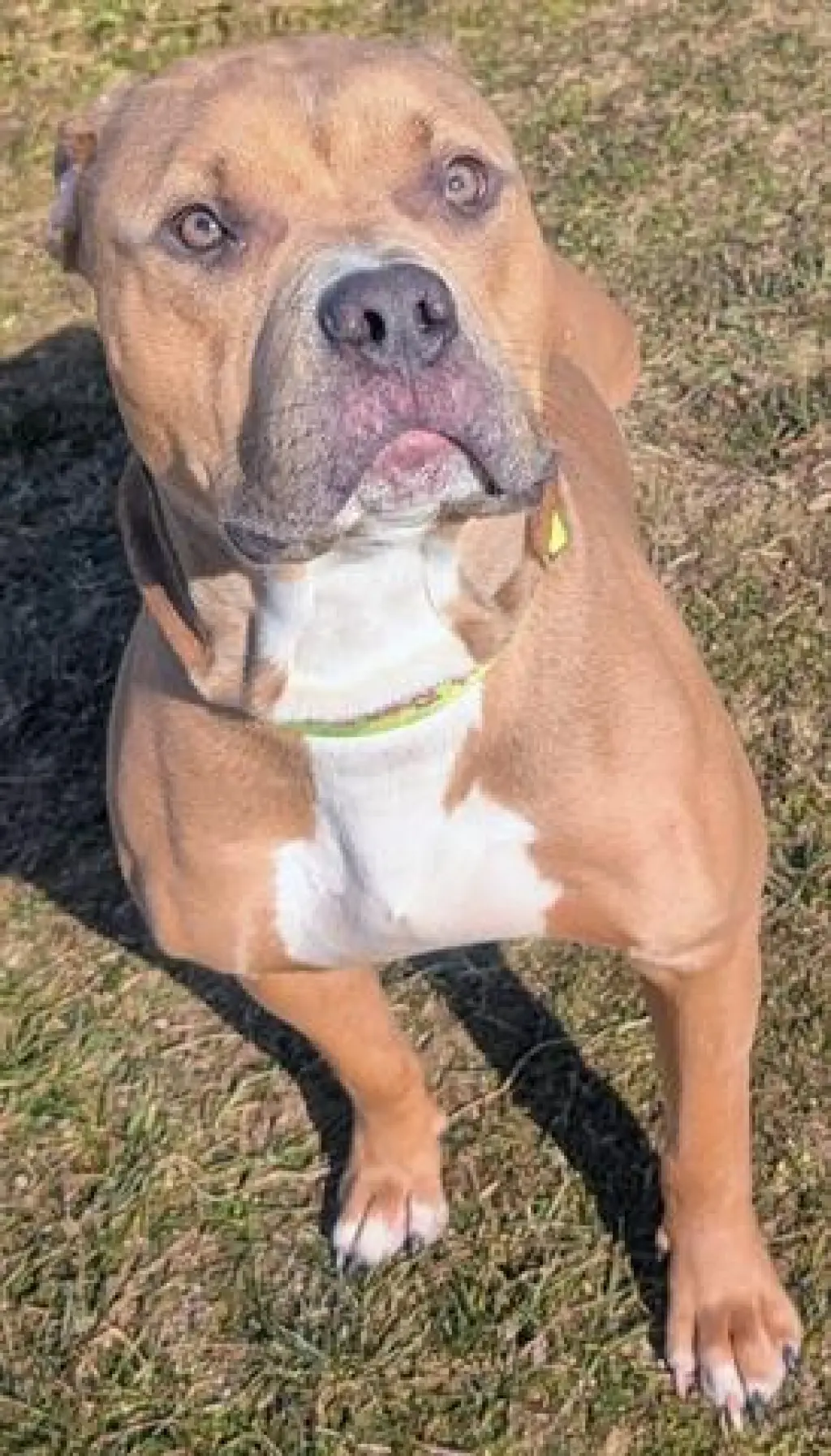 NASH