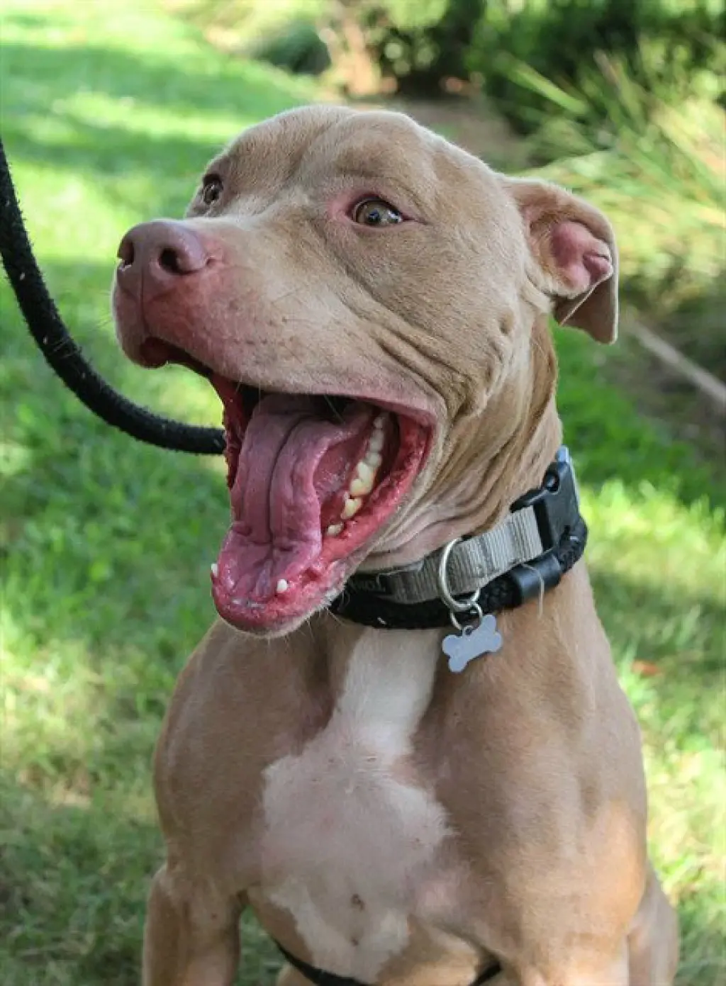 ZYLA