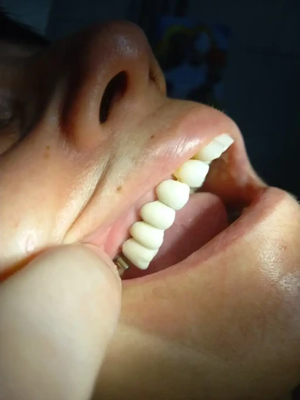 ODONTOLOGIA PRIVADA IMPLANTES