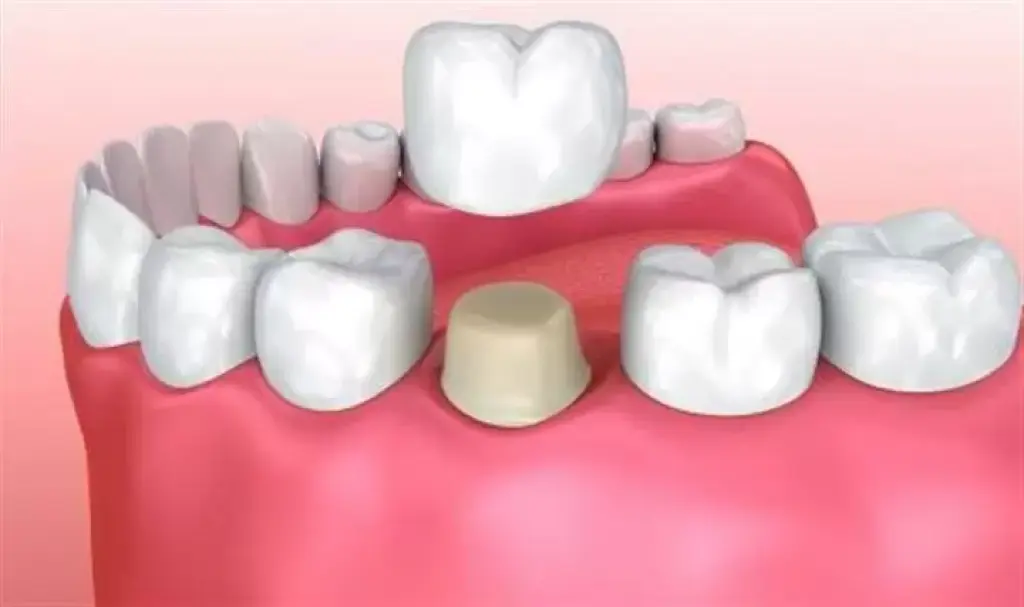DENTISTA DE CONFIANZA