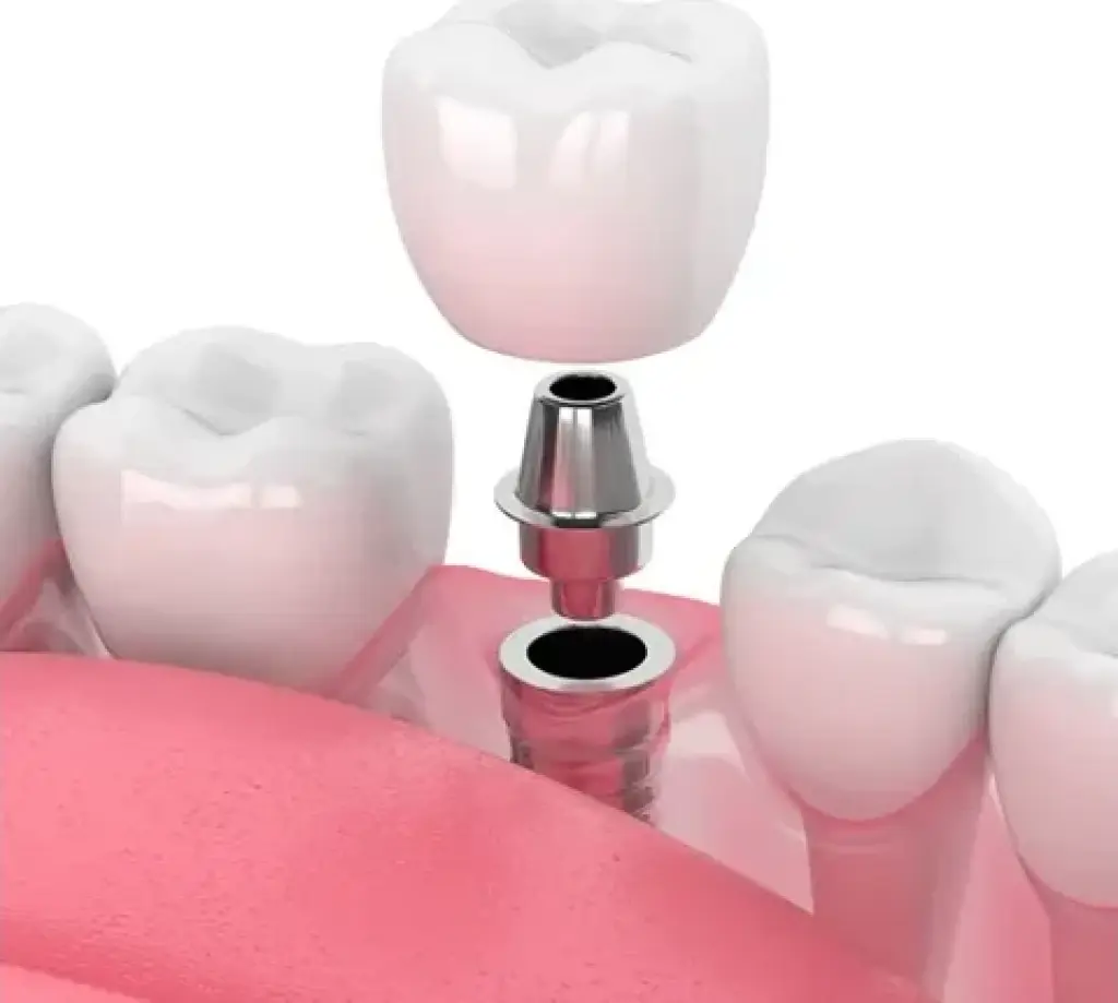 Dentista en Upland
