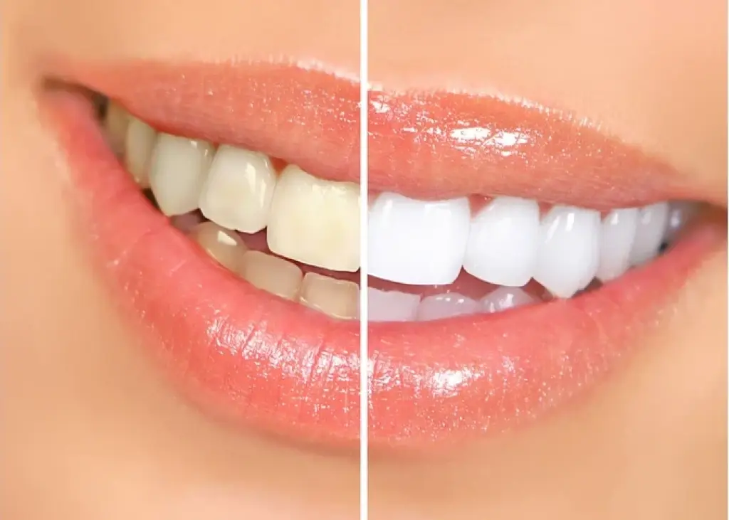Dentista Cosmético