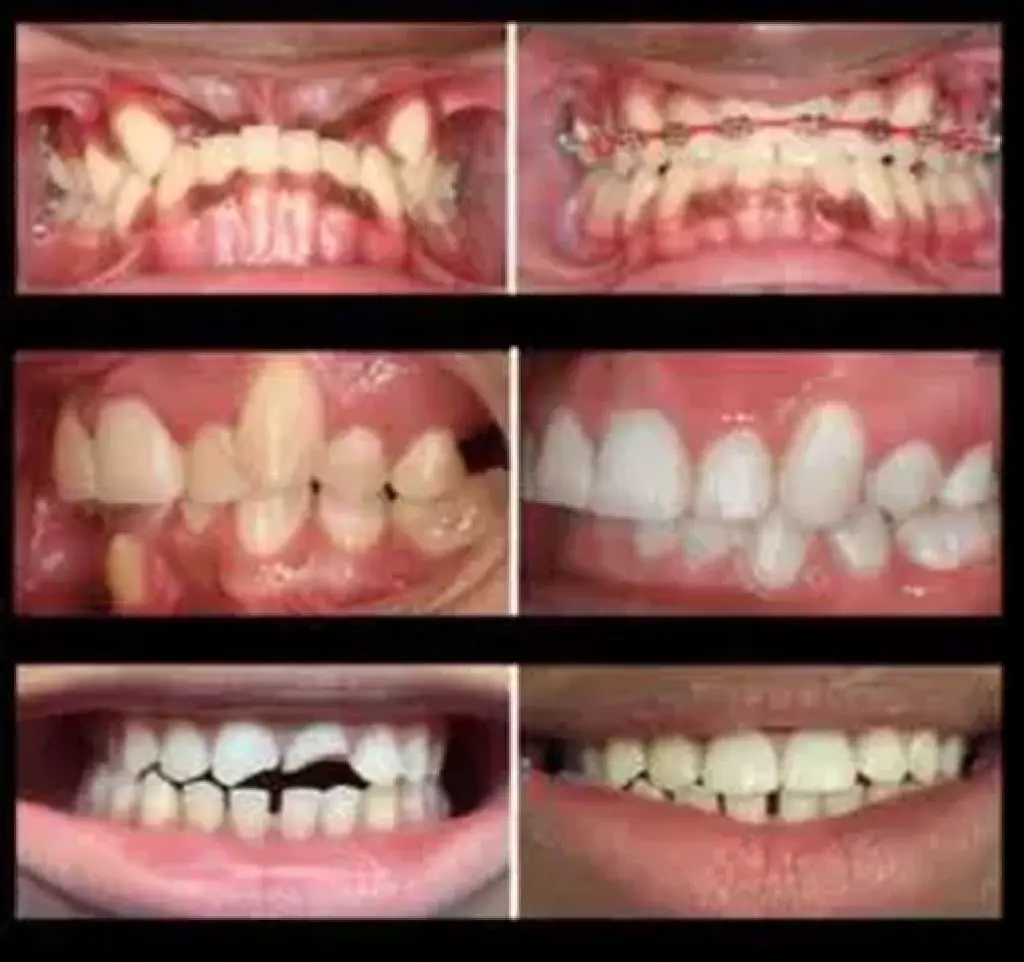 SONRISA PERFECTA EN VAN NUYS