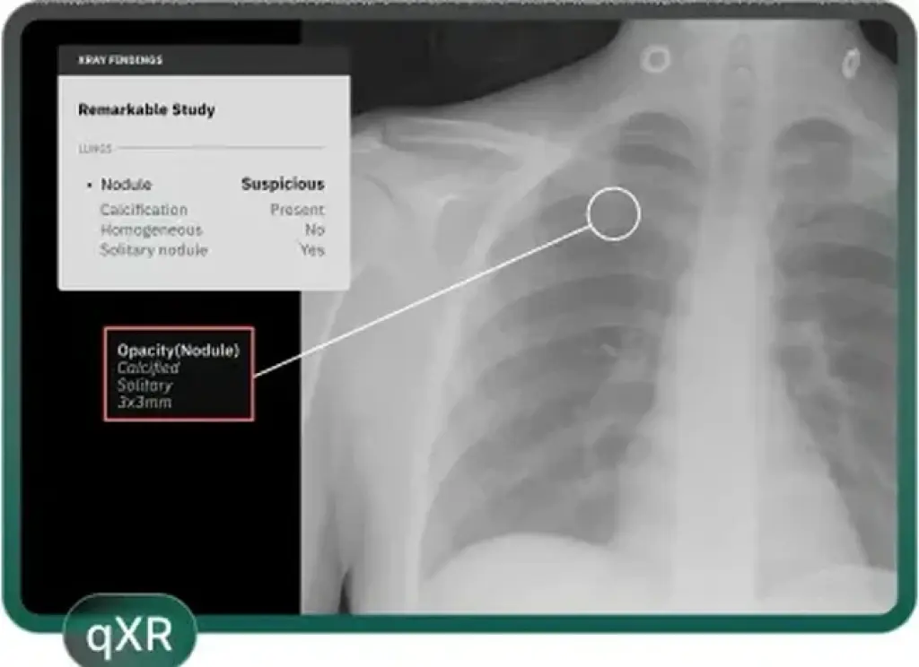 AI Detection & Follow-Up