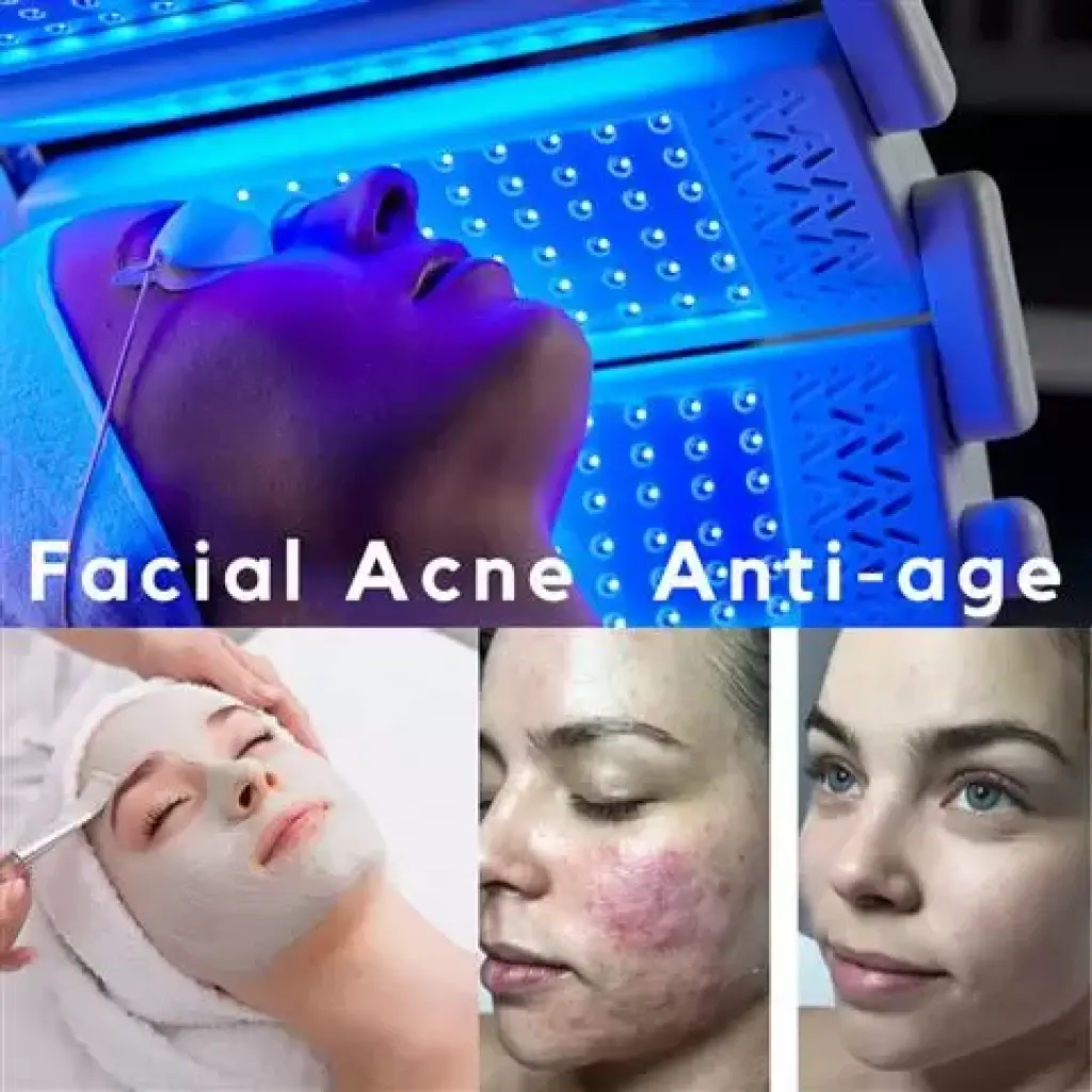 FACIAL ACNE LIMPIEZA PROFUNDA
