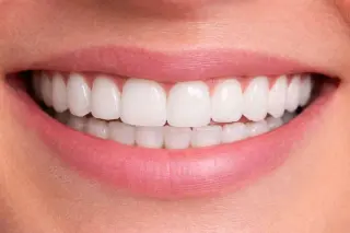 🦷 Limpieza Dental Profesional en Pico Rivera — Smile Avenue Dental Group