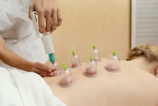BIOMAGNETISMO CUPPING DOLORES