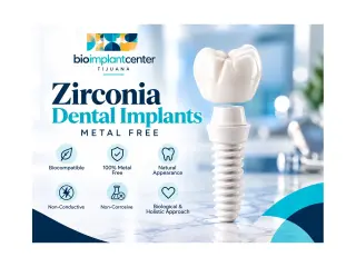 Implantes dentales de zirconia en Tijuana
