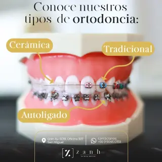 Clínica Dental en San Miguel | Zanh