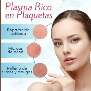 Plasma rico en plaquetas, tratamiento anti envejecimiento piel