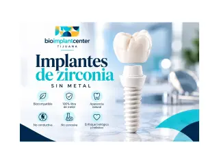 Implantes dentales de zirconia en Tijuana