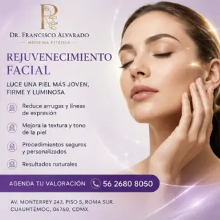 ARMONIZACIÓN FACIAL - DISMINUYE / ELIMINA ARRUGAS - resultados naturales