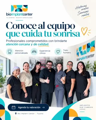 Implantes dentales de zirconia en Tijuana