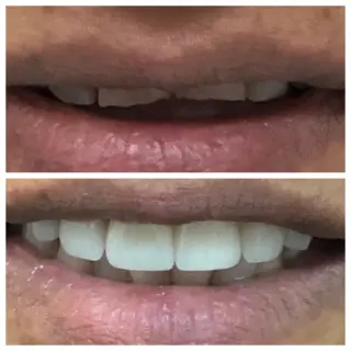 ¡Transforma Tu Sonrisa con Smile Avenue Dental Group!