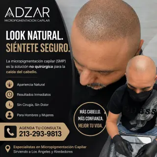 Servicios de Micropigmentación Capilar