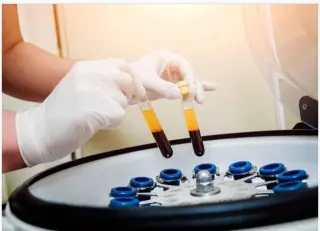 Plasma rico en plaquetas, tratamiento anti envejecimiento piel