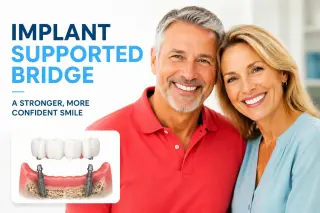 ¡Implantes Dentales en Pico Rivera — Smile Avenue Dental Group!