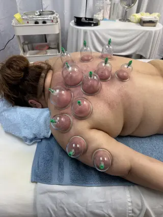 BIOMAGNETISMO CUPPING DOLORES