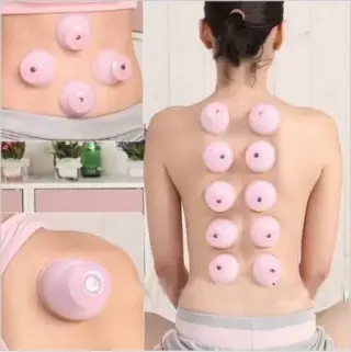 BIOMAGNETISMO CUPPING DOLORES