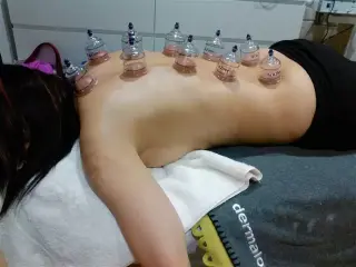 CIATICA  ESTRESS DOLORES