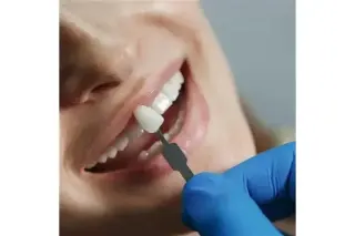 Implante dental en Escondido