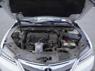 Acura TLX 2017 4dr Sedan