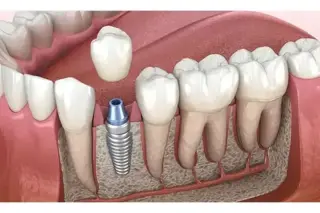 Clínica Dental Económica