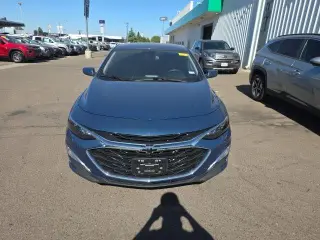 Chevrolet Malibu 2024 RS 4dr Sedan