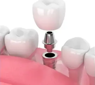 Dentista en Upland