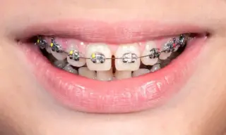 OBTENGA UNA SONRISA SALUDABLE