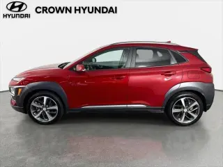 Hyundai KONA 2020 Ultimate 4dr Crossover
