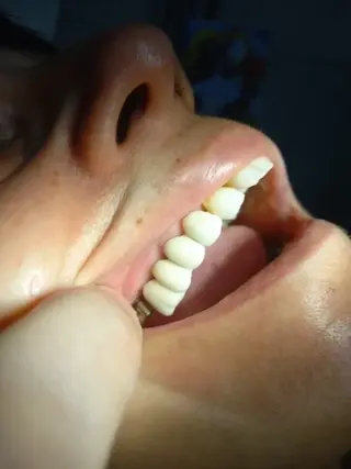 ODONTOLOGIA PRIVADA IMPLANTES
