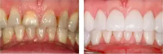 Hutchinson Metro Dental