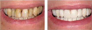 Hutchinson Metro Dental