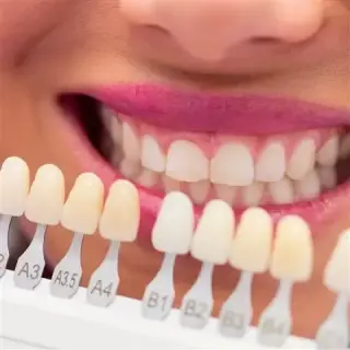 Implantes Dentales en Rialto