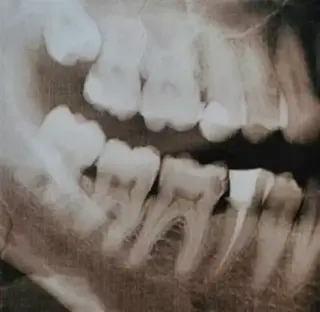 DENTISTA CON PRECIOS BAJOS