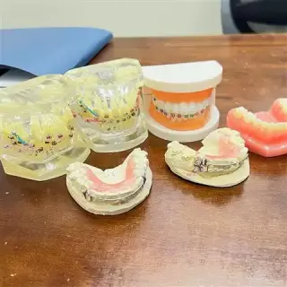 TRATAMIENTOS DENTALES