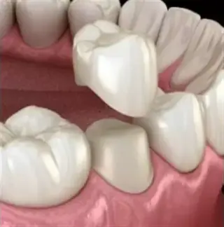 ¡PRÓTESIS DENTALES!