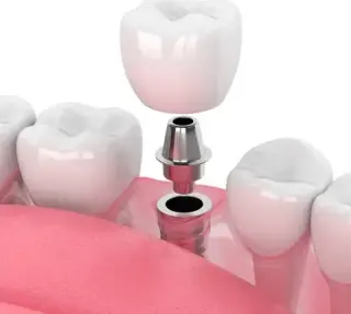 Dentista en Upland