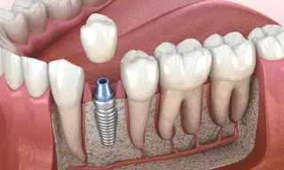 Clínica Dental Económica
