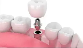 DENTISTA DE UCLA
