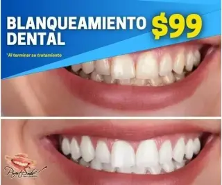 Dolor de muela? Perfect Smile