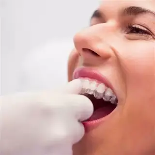 Dentista Cosmético en Rialto